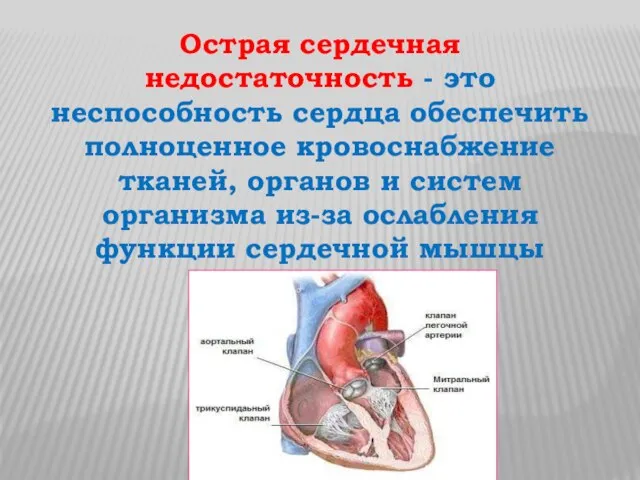 Острая сердечная недостаточность - это неспособность сердца обеспечить полноценное кровоснабжение тканей,