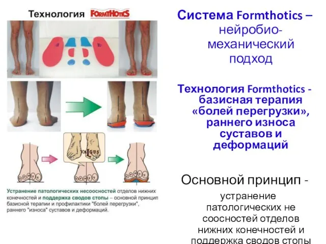 Система Formthotics – нейробио-механический подход Технология Formthotics - базисная терапия «болей