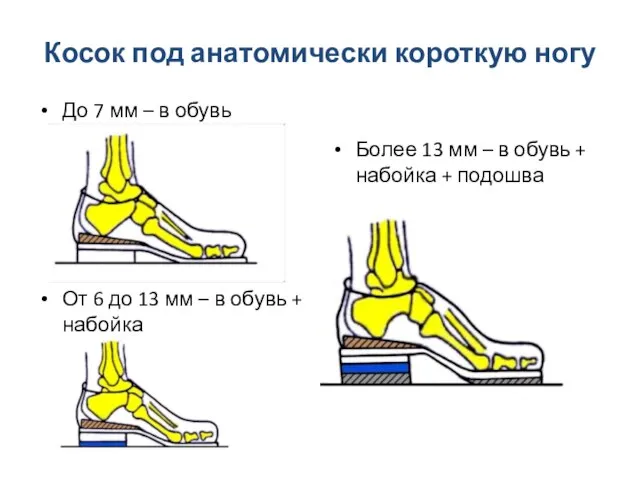 Косок под анатомически короткую ногу До 7 мм – в обувь