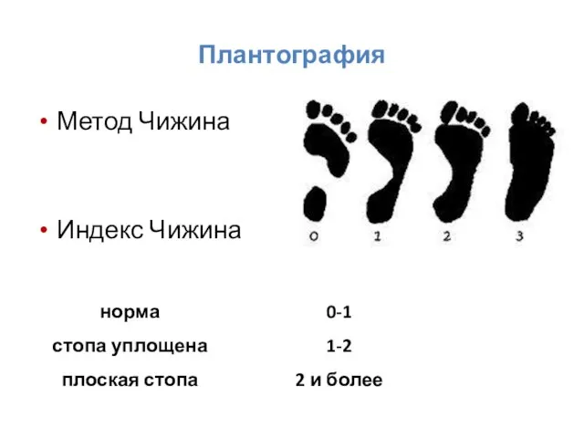 Плантография Метод Чижина Индекс Чижина