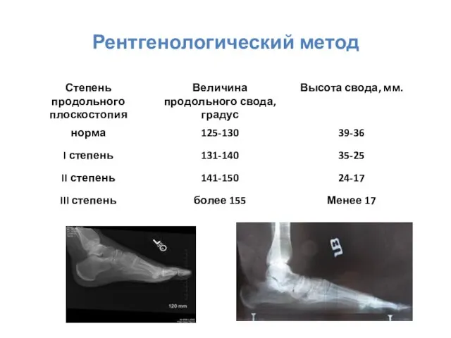 Рентгенологический метод