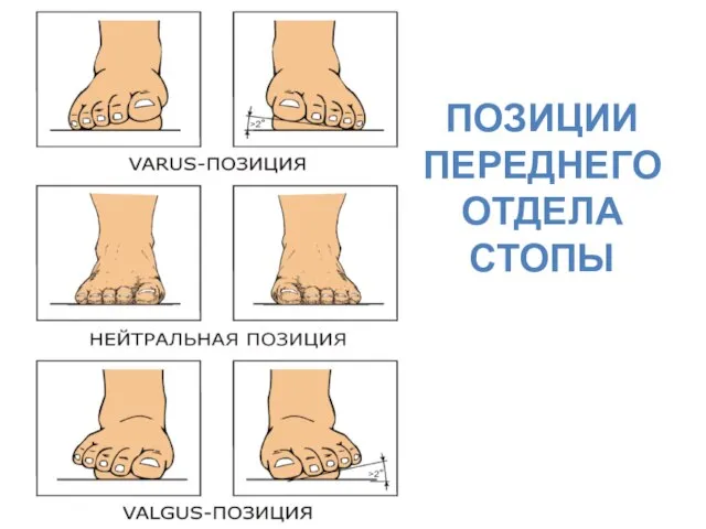 ПОЗИЦИИ ПЕРЕДНЕГО ОТДЕЛА СТОПЫ ПЕРЕДНЕГО ОТДЕЛА СТОПЫ