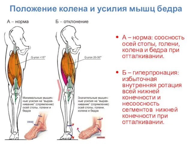 Положение колена и усилия мышц бедра А – норма: соосность осей