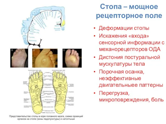 Стопа – мощное рецепторное поле Деформации стопы Искажения «входа» сенсорной информации