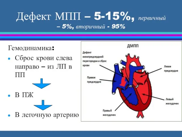 Дефект МПП – 5-15%, первичный – 5%, вторичный - 95% Гемодинамика: