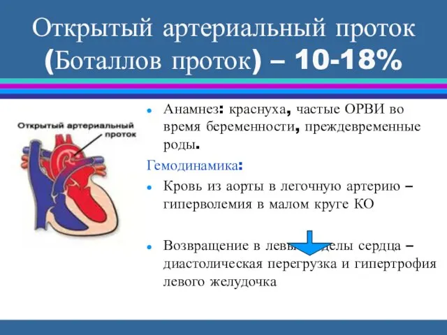 Открытый артериальный проток (Боталлов проток) – 10-18% Анамнез: краснуха, частые ОРВИ