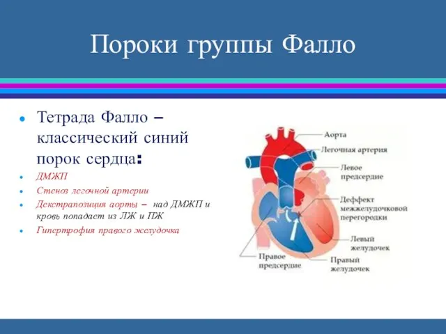 Пороки группы Фалло Тетрада Фалло – классический синий порок сердца: ДМЖП