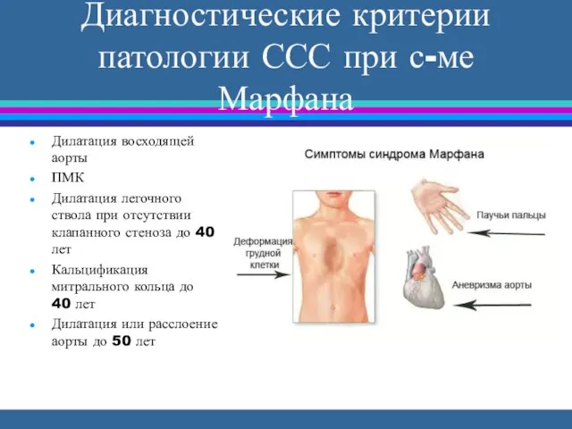 Диагностические критерии патологии ССС при с-ме Марфана Дилатация восходящей аорты ПМК