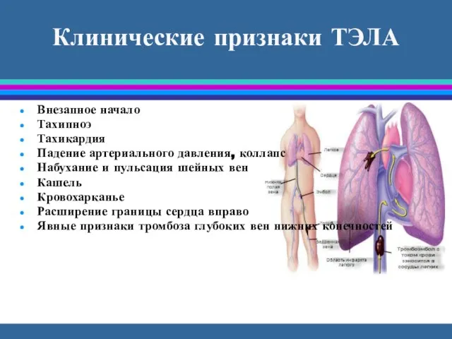 Клинические признаки ТЭЛА Внезапное начало Тахипноэ Тахикардия Падение артериального давления, коллапс