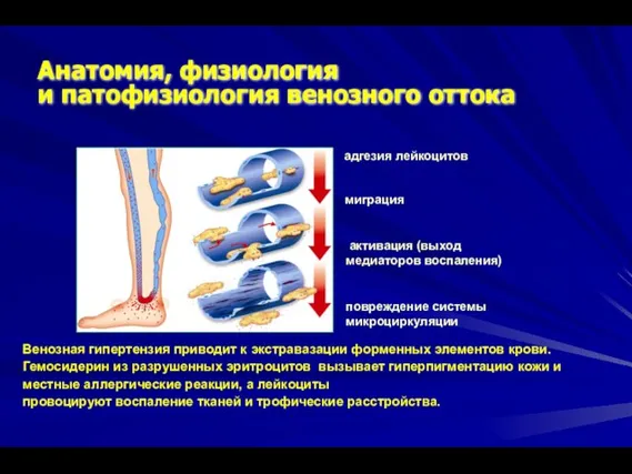 Анатомия, физиология и патофизиология венозного оттока Венозная гипертензия приводит к экстравазации