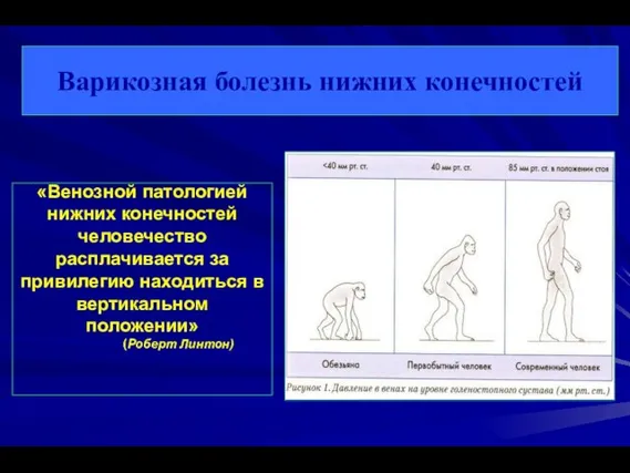 «Венозной патологией нижних конечностей человечество расплачивается за привилегию находиться в вертикальном