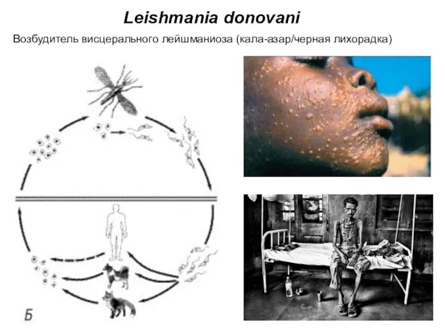 Leishmania donovani Возбудитель висцерального лейшманиоза (кала-азар/черная лихорадка)