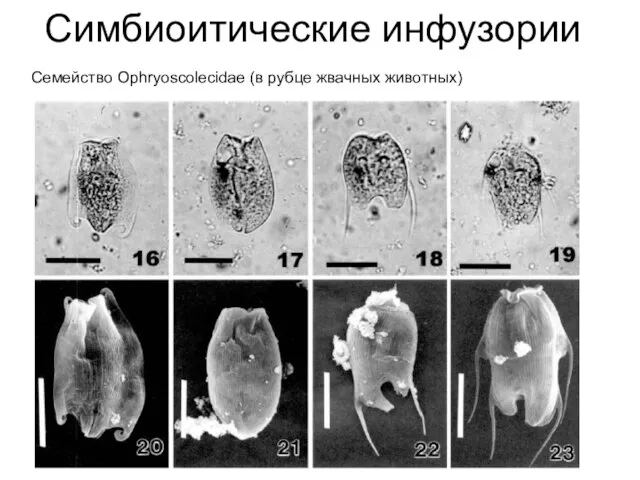 Симбиоитические инфузории Семейство Ophryoscolecidae (в рубце жвачных животных)