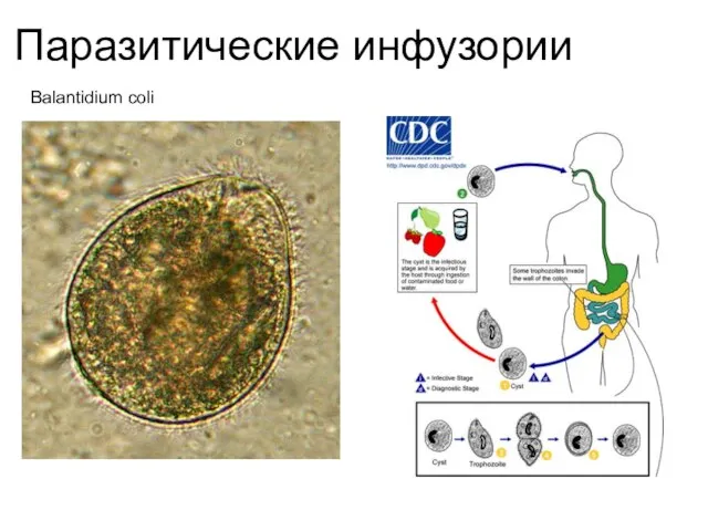 Паразитические инфузории Balantidium coli