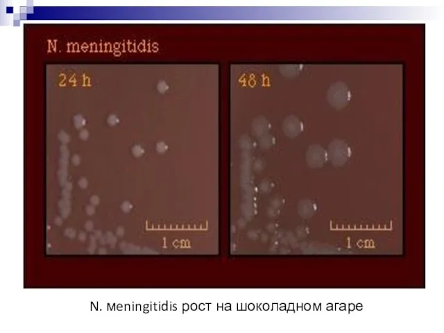 N. мeningitidis рост на шоколадном агаре