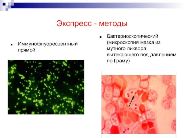 Экспресс - методы Иммунофлуоресцентный прямой Бактериоскопический (микроскопия мазка из мутного ликвора, вытекающего под давлением по Граму)