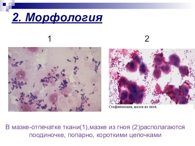 2. Морфология В мазке-отпечатке ткани(1),мазке из гноя (2)располагаются поодиночке, попарно, короткими цепочками 1 2