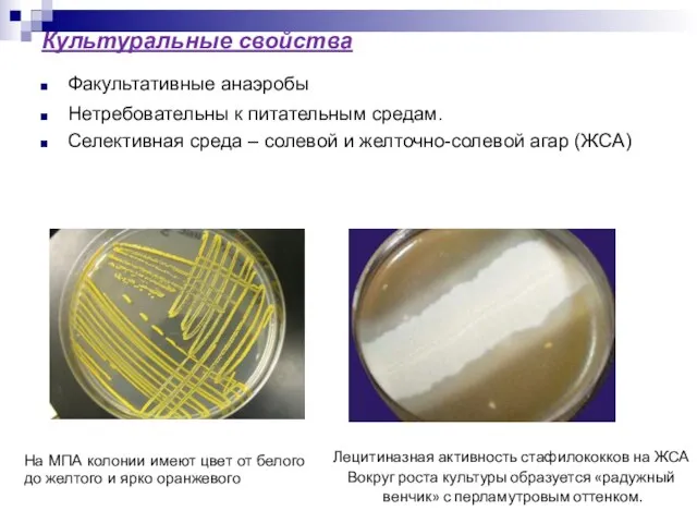 Культуральные свойства Факультативные анаэробы Нетребовательны к питательным средам. Селективная среда –