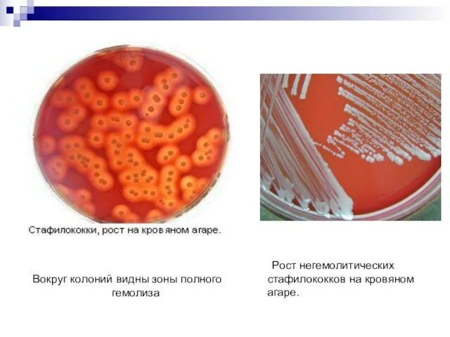 Вокруг колоний видны зоны полного гемолиза Рост негемолитических стафилококков на кровяном агаре.