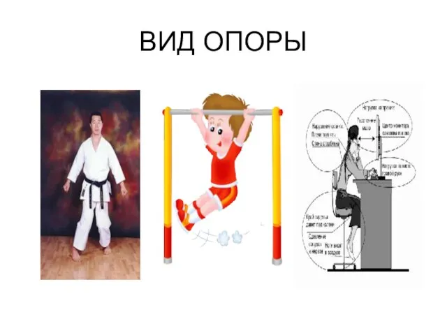 ВИД ОПОРЫ