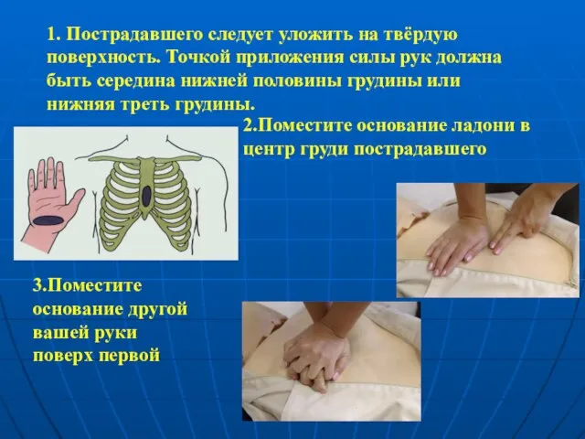 1. Пострадавшего следует уложить на твёрдую поверхность. Точкой приложения силы рук