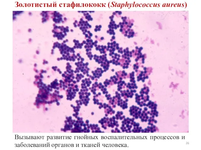 Золотистый стафилококк (Staphylococcus aureus) Вызывают развитие гнойных воспалительных процессов и заболеваний органов и тканей человека.