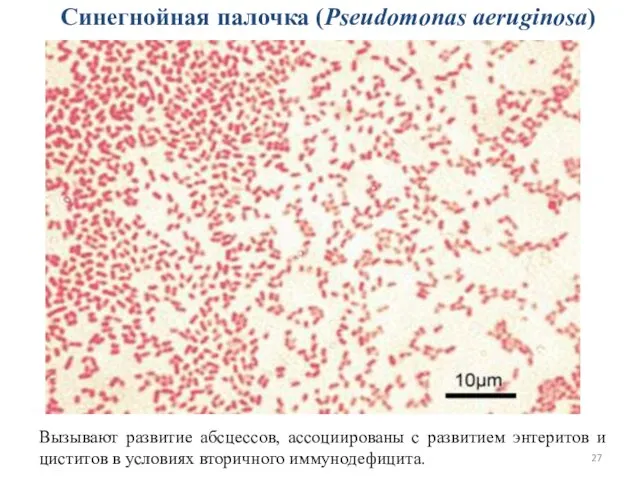 Синегнойная палочка (Pseudomonas aeruginosa) Вызывают развитие абсцессов, ассоциированы с развитием энтеритов