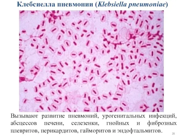 Клебсиелла пневмонии (Klebsiella pneumoniae) Вызывают развитие пневмоний, урогенитальных инфекций, абсцессов печени,