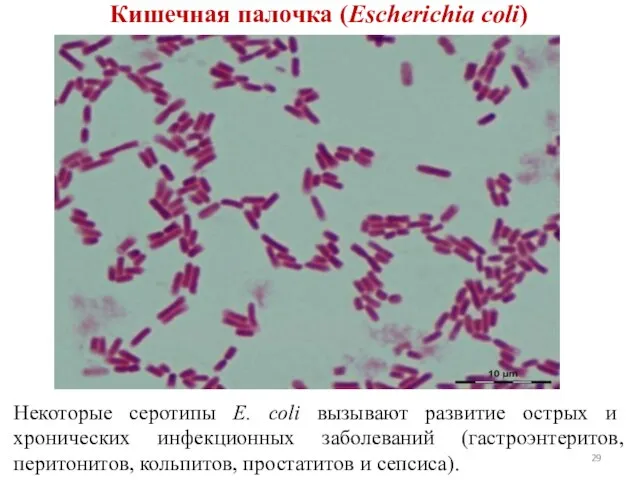 Кишечная палочка (Escherichia coli) Некоторые серотипы E. coli вызывают развитие острых