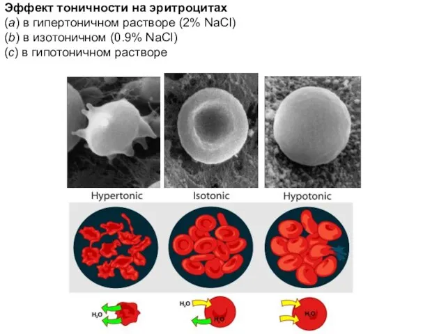 Эффект тоничности на эритроцитах (a) в гипертоничном растворе (2% NaCl) (b)