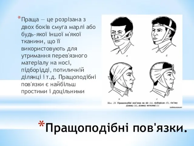 Пращоподібні пов'язки. Праща — це розрізана з двох боків смуга марлі