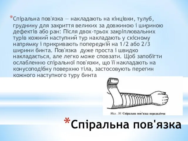 Спіральна пов'язка Спіральна пов'язка — накладають на кінцівки, тулуб, груднину для