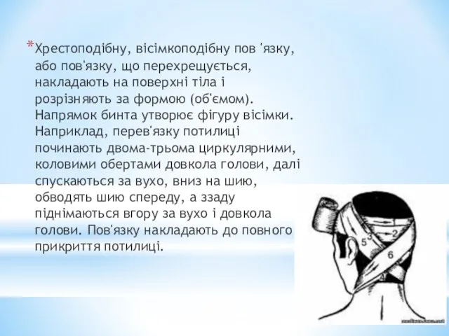 Хрестоподібну, вісімкоподібну пов 'язку, або пов'язку, що перехрещується, накладають на поверхні