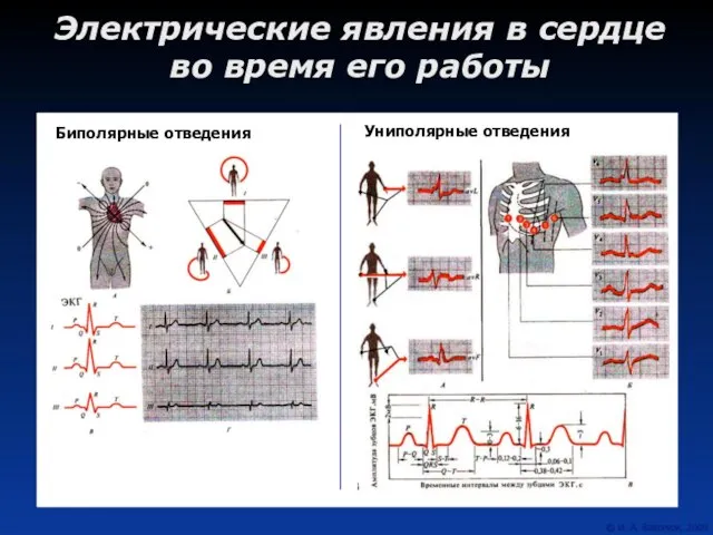 Электрические явления в сердце во время его работы Биполярные отведения Униполярные отведения