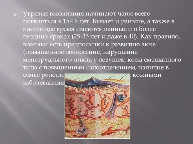 . Угревые высыпания начинают чаще всего появляться в 15-16 лет. Бывает