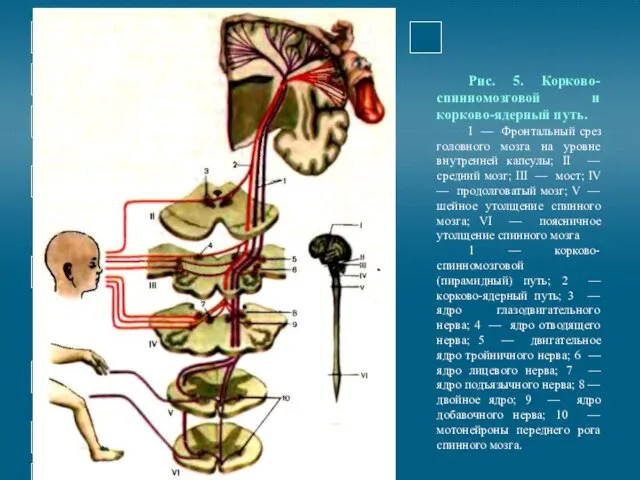 Рис. 5. Корково-спинномозговой и корково-ядерный путь. I — Фронтальный срез головного