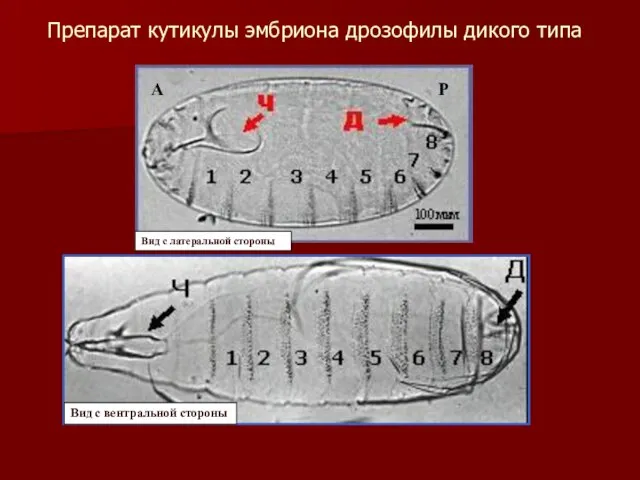 Препарат кутикулы эмбриона дрозофилы дикого типа А Р Вид с латеральной стороны Вид с вентральной стороны