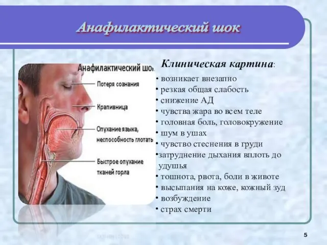 Анафилактический шок возникает внезапно резкая общая слабость снижение АД чувства жара