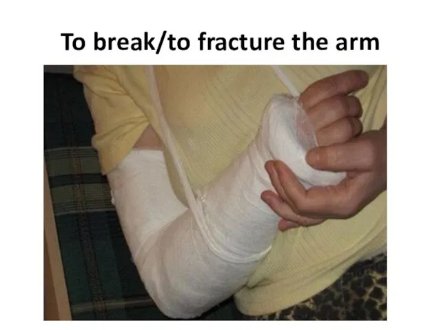 To break/to fracture the arm