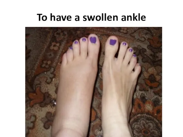 To have a swollen ankle