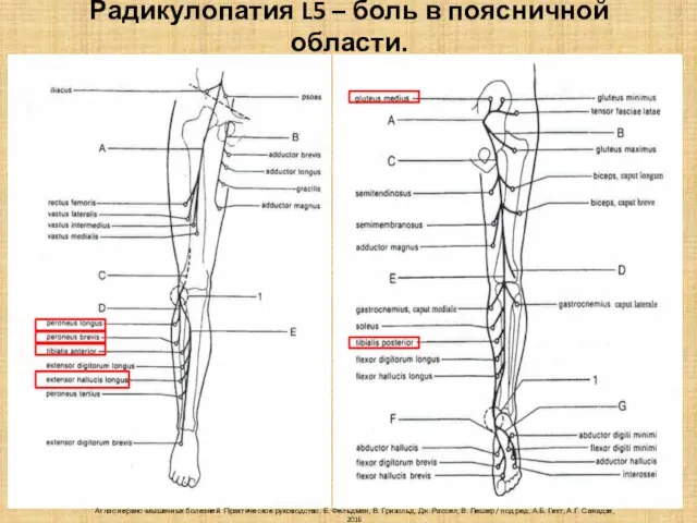 Радикулопатия L5 – боль в поясничной области. Атлас нервно-мышечных болезней. Практическое