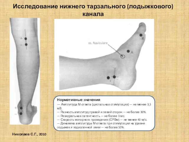 Исследование нижнего тарзального (лодыжкового) канала Нормативные значения — Амплитуда М-ответа (дистальная