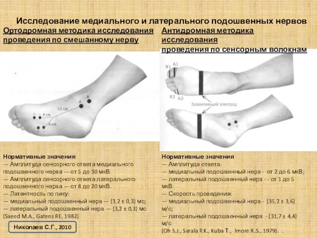 Исследование медиального и латерального подошвенных нервов Нормативные значения — Амплитуда сенсорного