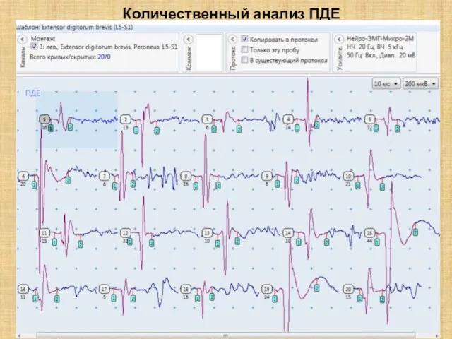 Количественный анализ ПДЕ