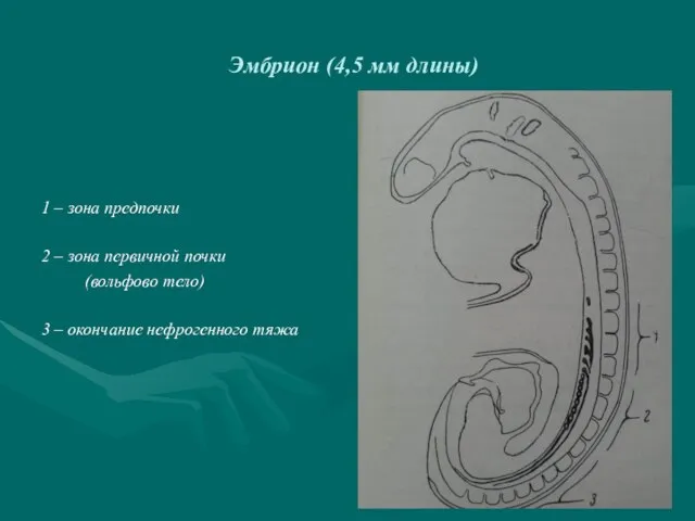 Эмбрион (4,5 мм длины) 1 – зона предпочки 2 – зона