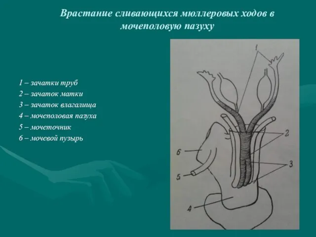 Врастание сливающихся мюллеровых ходов в мочеполовую пазуху 1 – зачатки труб