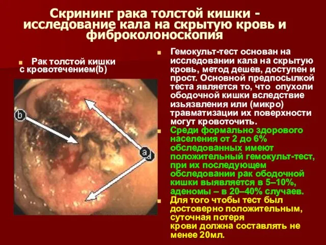 Скрининг рака толстой кишки - исследование кала на скрытую кровь и