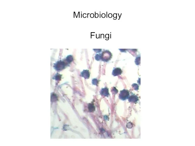 Microbiology Fungi