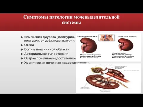 Симптомы патологии мочевыделительной системы Изменения диуреза ( полиурия, олигурия анурия, ишурия,