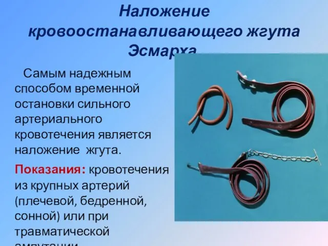 Наложение кровоостанавливающего жгута Эсмарха. Самым надежным способом временной остановки сильного артериального